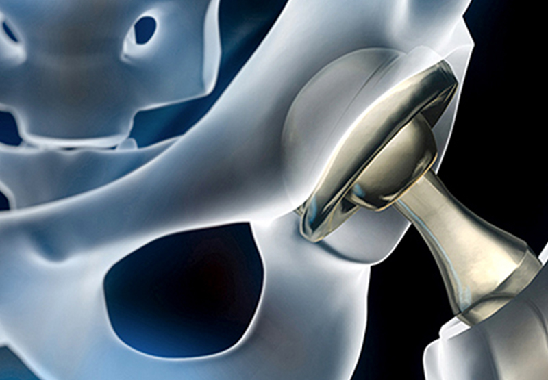 Medical Device Surface Treatment Solutions